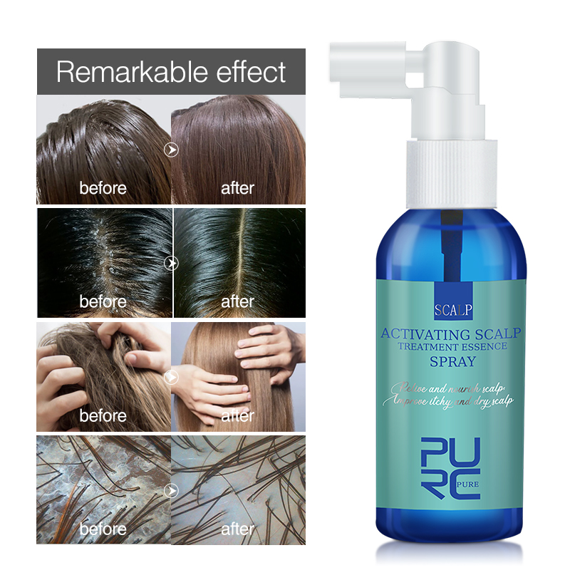 Hair Scalp Treatment Essence Spray Anti-Dandruff Smoothing S-图3