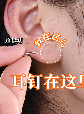 钛合金杆养耳免摘透肤替换头隐形