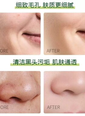 梦希蓝野菜焕颜清洁霜按摩霜深层清洁毛孔污垢堵塞脏东西去角质女