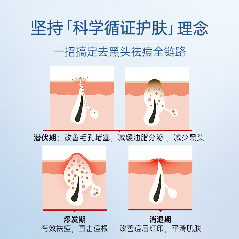 质润15%壬二酸凝胶祛痘控油面霜去痘痘去黑头净颜修护痘肌