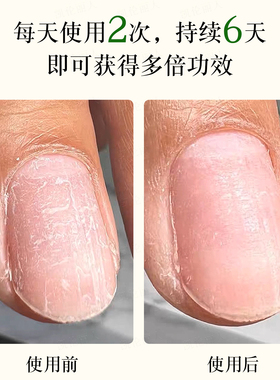 蛋白护甲油repairmode强化T200
