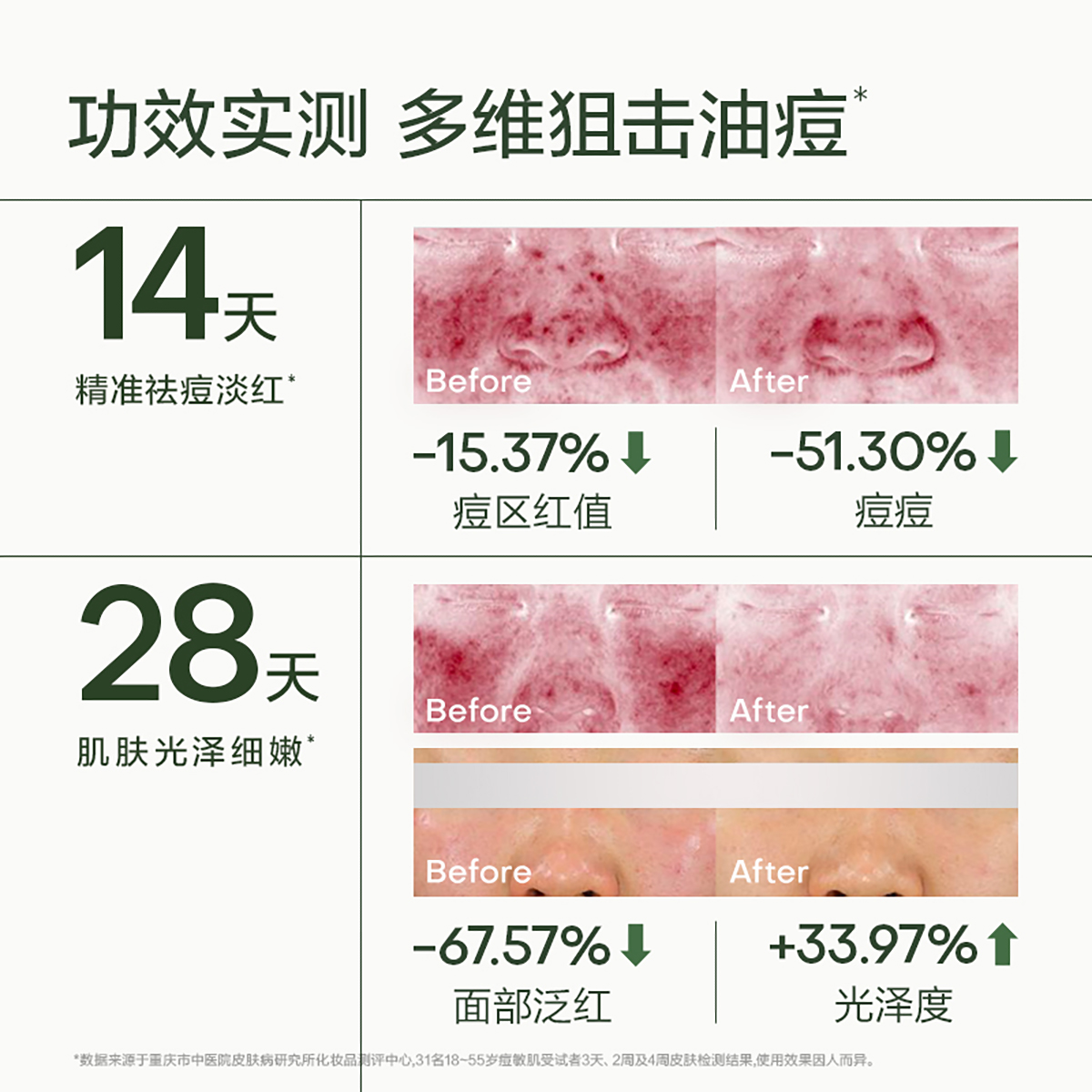 【U先】安敏优青蒿舒缓祛痘淡印控油收缩毛孔去闭口修护精华3支