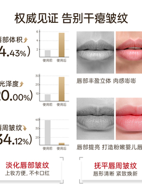 Silk'n 丝可 LumiLips唇光宝唇部美容仪 胶原家用美容面罩送礼238