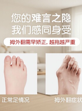 脚趾矫正器拇指外翻分趾器纠正大母足脚趾头大脚骨突出神器男女士