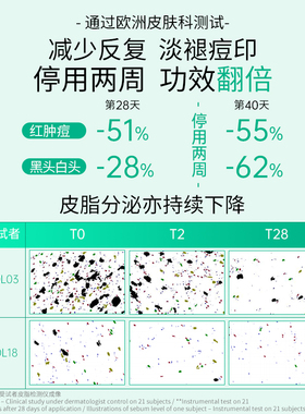 Topicrem特碧润祛痘控油平衡乳淡痘印修护屏障舒缓调理肌肤收毛孔