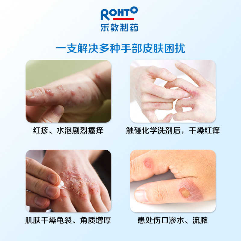 日本乐敦曼秀雷敦Medi Quick手湿疹皮炎止痒软膏蚊虫叮咬全身可用,淘宝优惠券,粉丝福利购,淘宝优惠卷