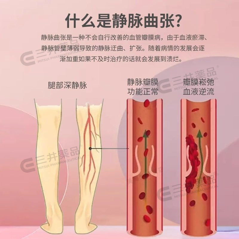 日本原装进口卫材Eisai静脉曲张动脉硬化微循环活化剂胶囊100粒,淘宝优惠券,粉丝福利购,淘宝优惠卷