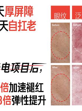 修护屏障厚脸皮冻干次抛精华液