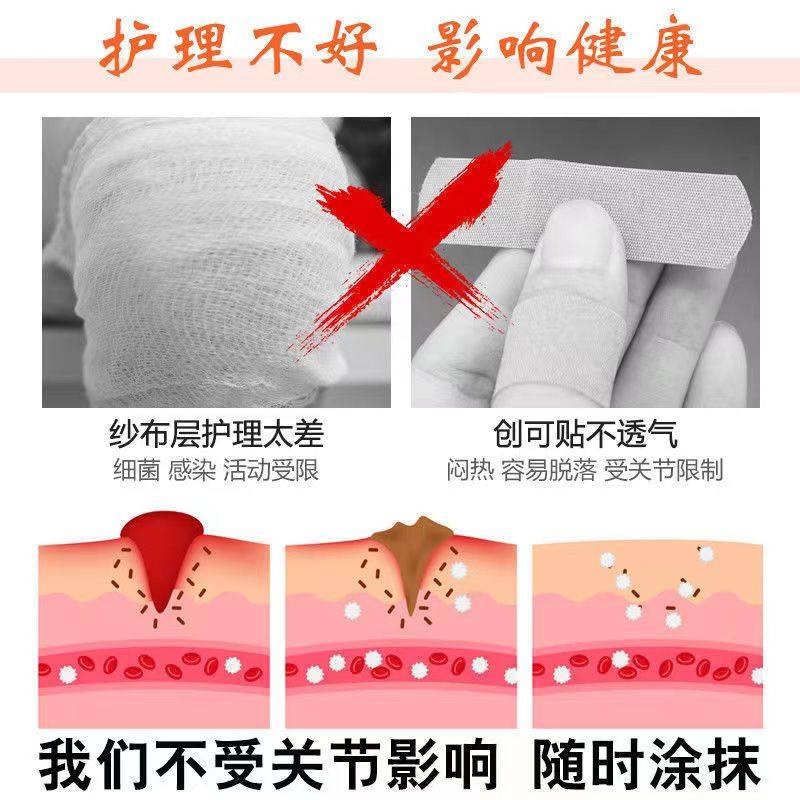 伤口护理软膏手术伤口愈合快速结痂消炎杀菌修复万能膏擦伤破皮药_虎窝淘