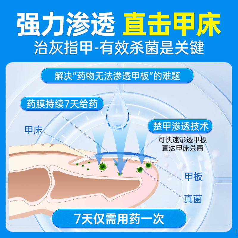 楚甲盐酸阿莫罗芬搽剂1.5ml灰指甲专用药正品旗舰店甲癣空甲增厚 - 图3