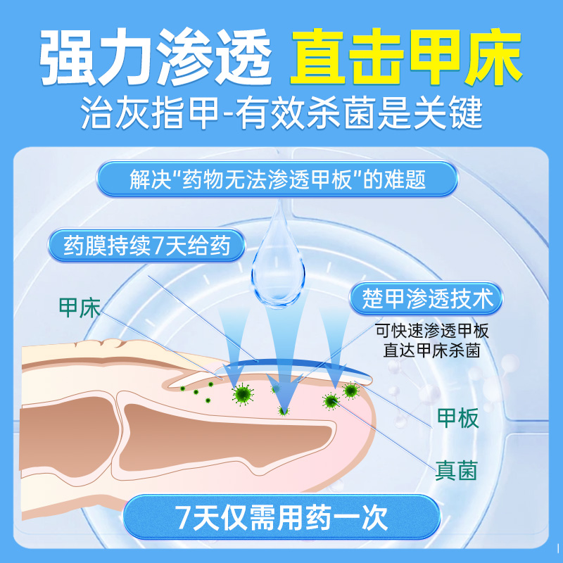 楚甲盐酸阿莫罗芬搽剂0.5ml/盒灰指甲专用药旗舰店特效治疗正品 - 图3