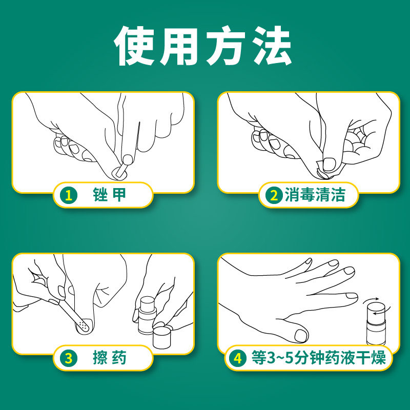 楚甲盐酸阿莫罗芬搽剂2.5 ml甲癣 福邦医药癣症