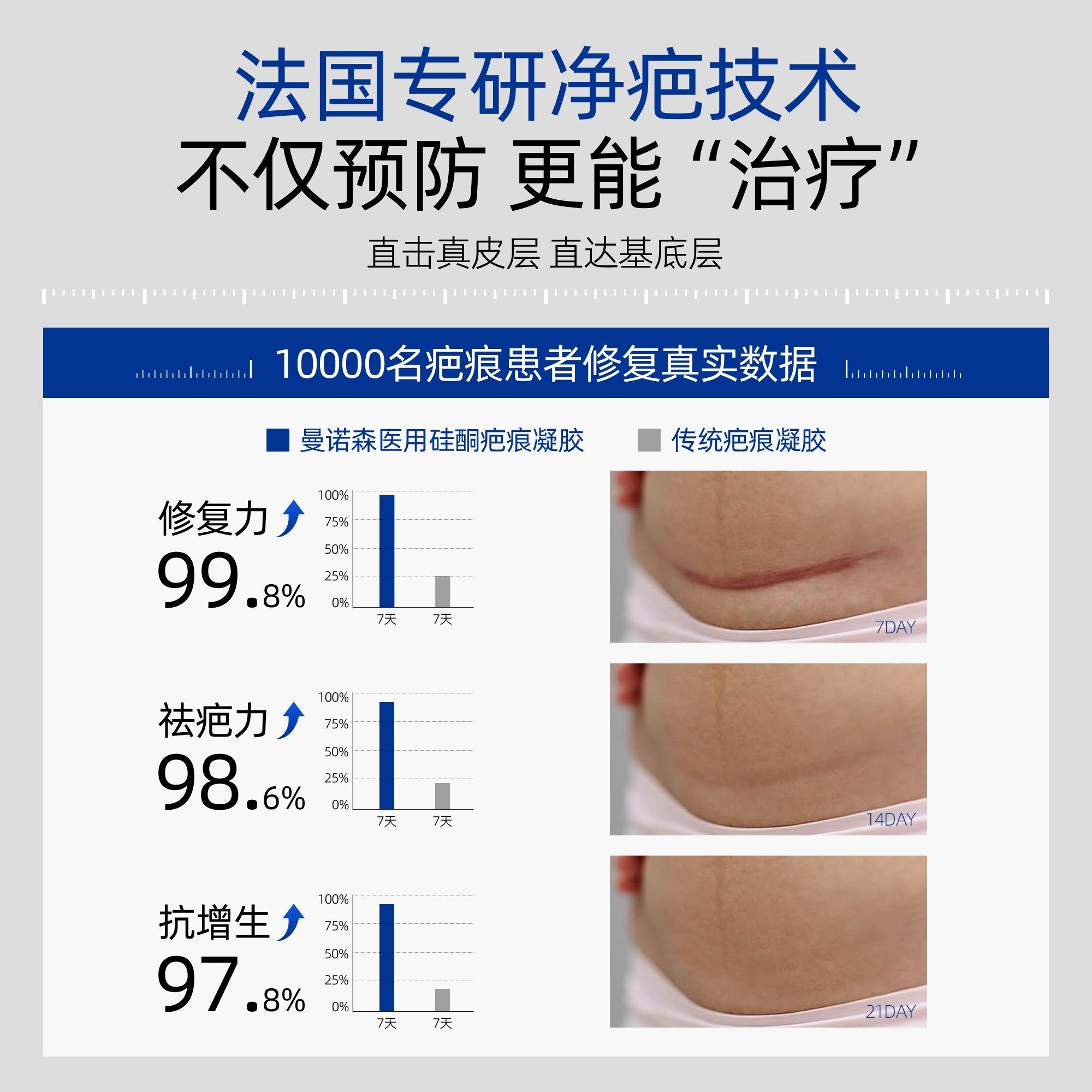 祛疤膏医用硅酮凝胶敷料手术烫伤淡化修复疤痕贴增生凸起除疤产品,淘宝优惠券,粉丝福利购,淘宝优惠卷