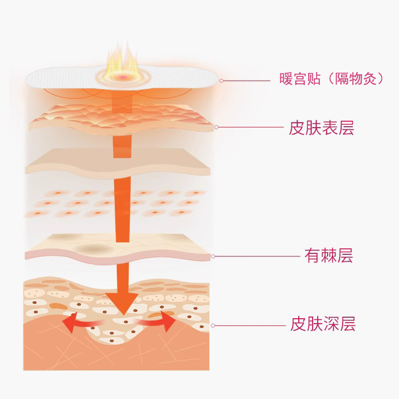 纽西护士发热贴大姨妈暖宫贴（隔物灸）防宫寒缓解痛经3贴/袋 - 图2