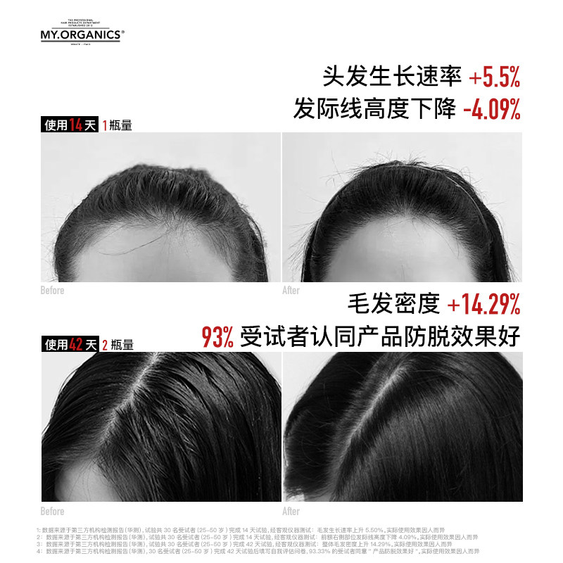 myorganics活力喷雾防脱固发密发精华 发际线喷雾头皮护理精华液