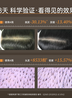 【达人专属】【达播】玻麦妍5000+PPM麦角硫因头皮焕活精华温和