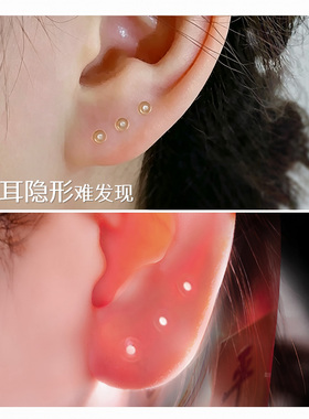 扩耳洞透明玻璃钉防堵塞闭合肤色