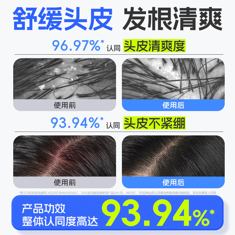 艾芭薇青少年洗发水去屑控油蓬松青春期男孩女孩学生洗护专用正品