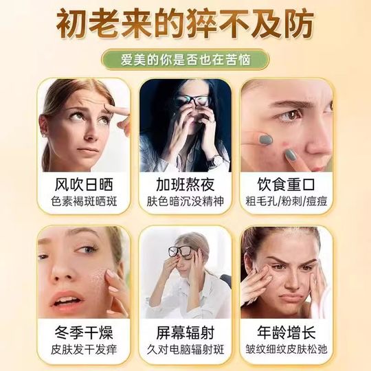 Beijing Tong Ren Tang Vitamin E Weichkapsel Frauen natürliche interne Ergänzung VE externe Hautpflege Weichkapsel E echt