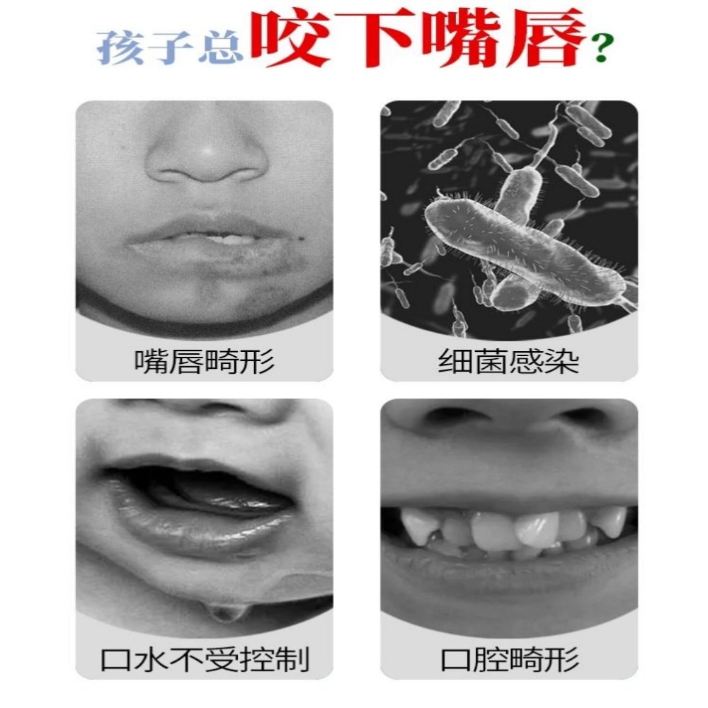 防咬下嘴唇神器小孩矫正器宝宝口呼吸儿童凸嘴舔吸手指苦瓜水