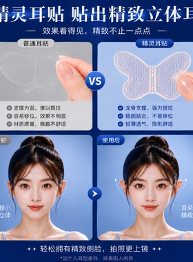 隐形强支撑显脸小新娘精灵耳贴