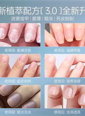 护甲油防倒刺指缘油养甲床受损用