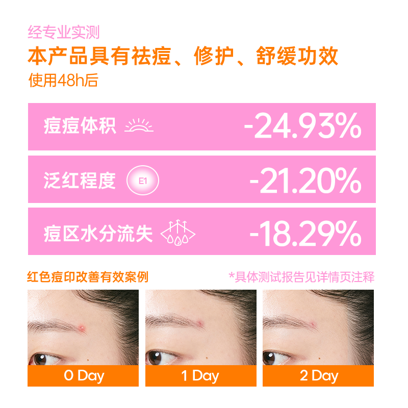 Fidoo浮汀痘痘贴祛痘修护舒缓隔离轻薄妆容脸贴可爱卡通妆饰,淘宝优惠券,粉丝福利购,淘宝优惠卷