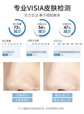 美国进口鼻贴去黑头粉刺闭口导出液收缩毛孔神器海外旗舰店ohbt
