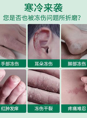 HEALMUSZ獾油烧伤冻伤膏25g*4罐