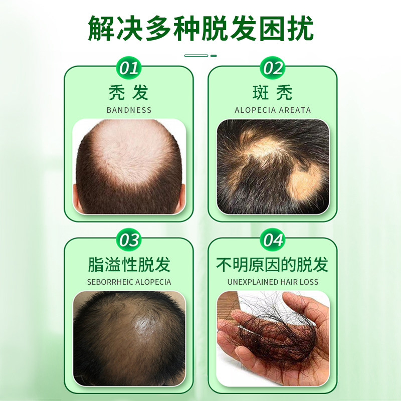  广岳堂大药房白发脱发