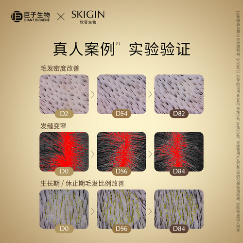 【一周体验】巨子生物SKIGIN欣苷双舱养发小金瓶人参灵芝五黑饮 - 图2