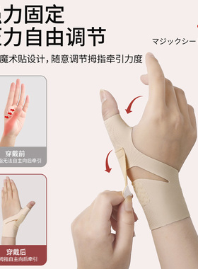 拇指手腕扭伤腱鞘疼痛轻薄款护腕