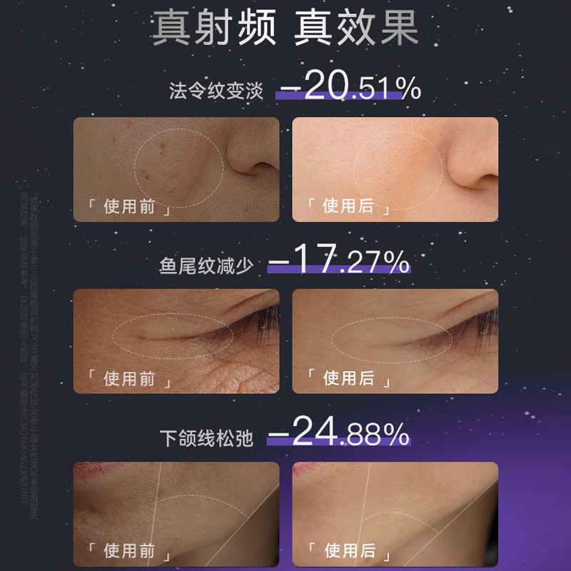 ANLAN安兰提拉紧致面部美容仪红蓝光眼部脸部光子嫩肤导入射频仪