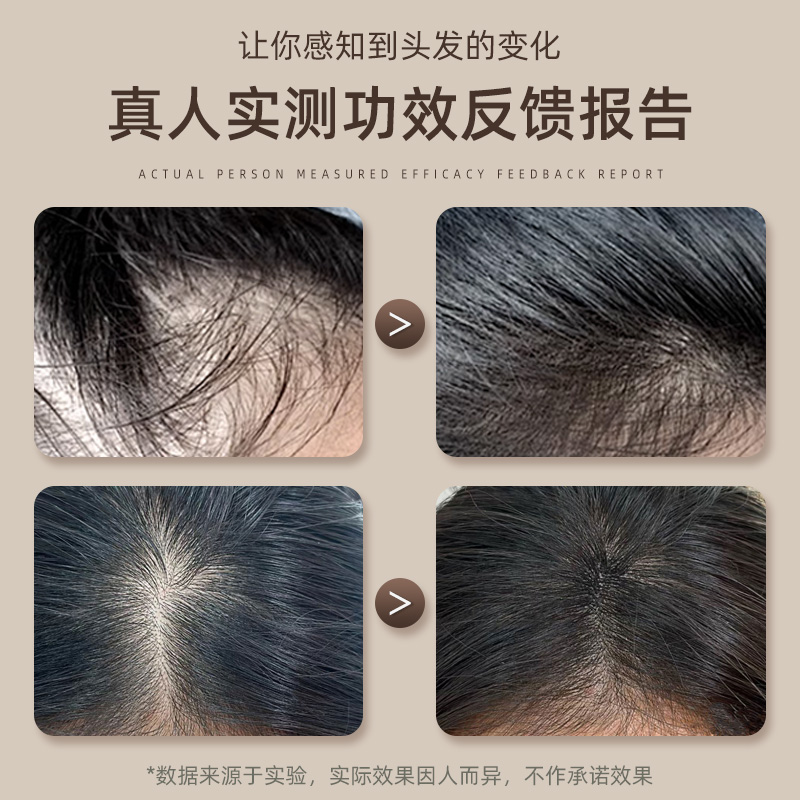 熊教授韵嘉植物洗发水液防脱生发育发固发控油蓬松男女士旗舰店 - 图2