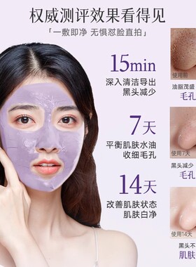 离岛日记紫苏清洁泥膜收缩毛孔去黑头粉刺深层清洁面部涂抹式面膜