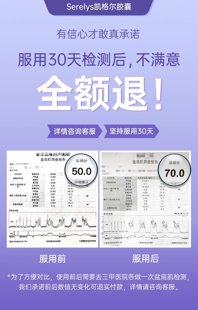 法国Serelys凯格尔胶囊盆底肌养护盆底宝活力素产后恢复口服30粒