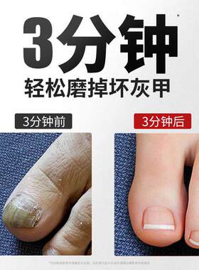 电动打磨机灰指甲修脚神器