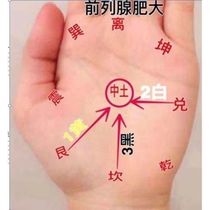 Traditional Chinese Medicine Books Gossip Hand Acupuncture Therapy Latest Five Lines Five Color Hand Acupuncture Therapy Information Treasures