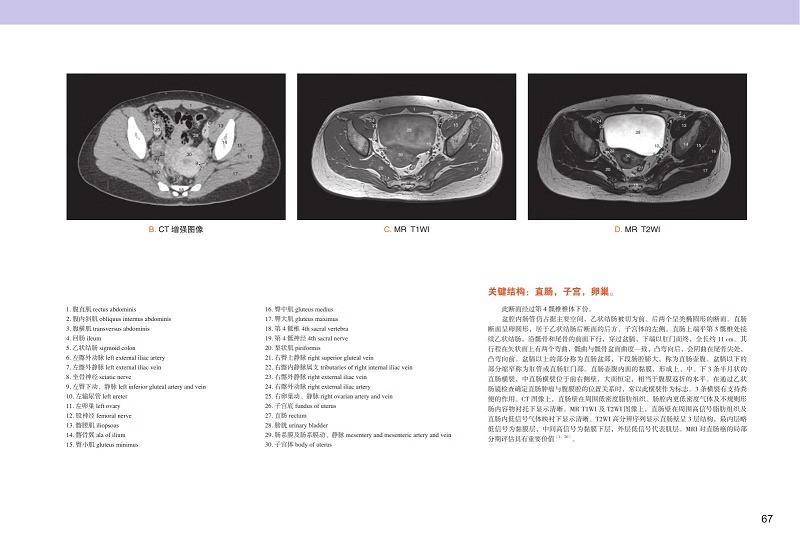 【书】数字人连续横断层解剖学彩色图谱盆部与会阴分册林祥涛王青吴凤霞断层标本彩色图像螺旋CT图像山东科学技术出版书籍-图2