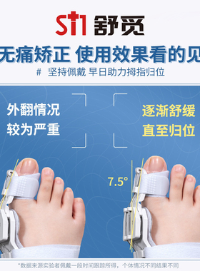 大脚趾外翻矫纠拇脚正整器分趾