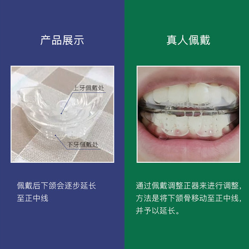 成人下巴后缩矫正器前突短下巴宽大过长厚调整下颌颚歪斜纠正神器 - 图2