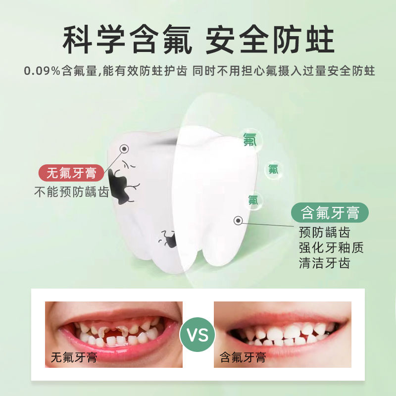 优卡丹益生菌儿童健齿防蛀牙膏宝宝3-12岁含氟护蛀修复换牙