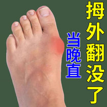 (Corrected 90 thousand people) Thumb Valgus Straightener Orthopus Toe valgus Toe Straightener Special Sticker