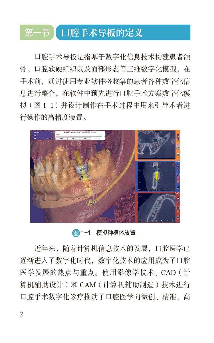 口腔手术导板三维打印规范 图解口腔美学种植修复临床规范 供医疗机构口腔医师 修复工艺技师等 中国医药科技出版社9787521442786