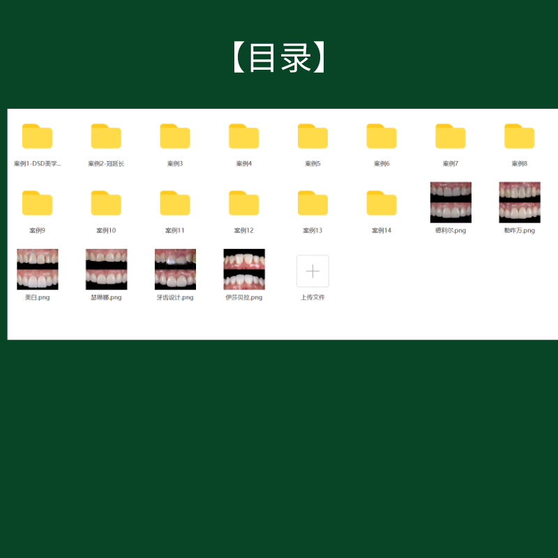 口腔美学修复案例14组 多数含面照和治疗前后对比照 外国模特 - 图2