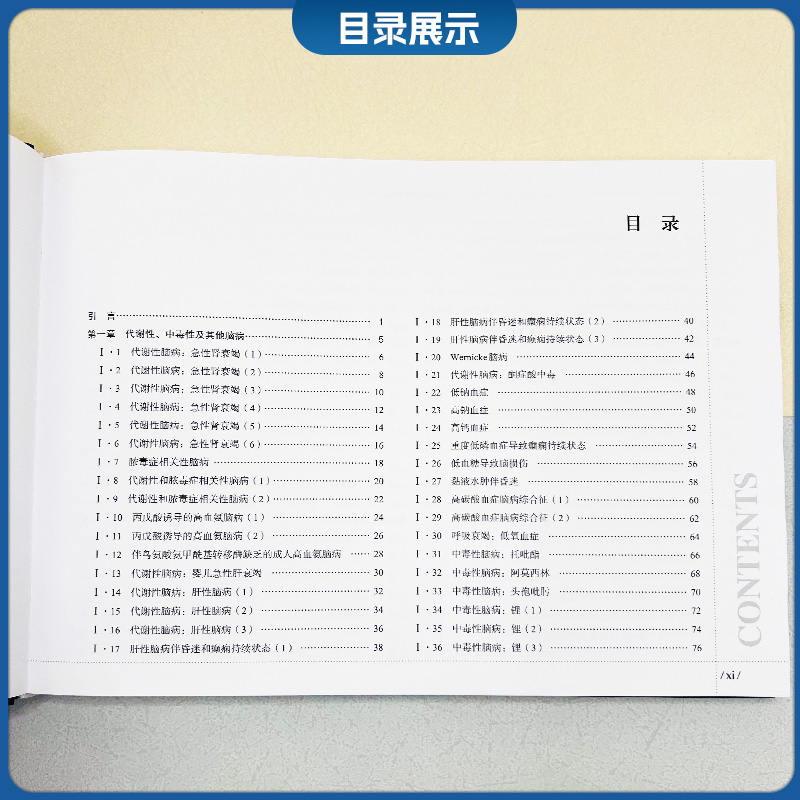 神经系统疾病和重症监护  脑电图图谱 第3卷 任连坤等主译 中国协和医科大学出版社 9787567923874