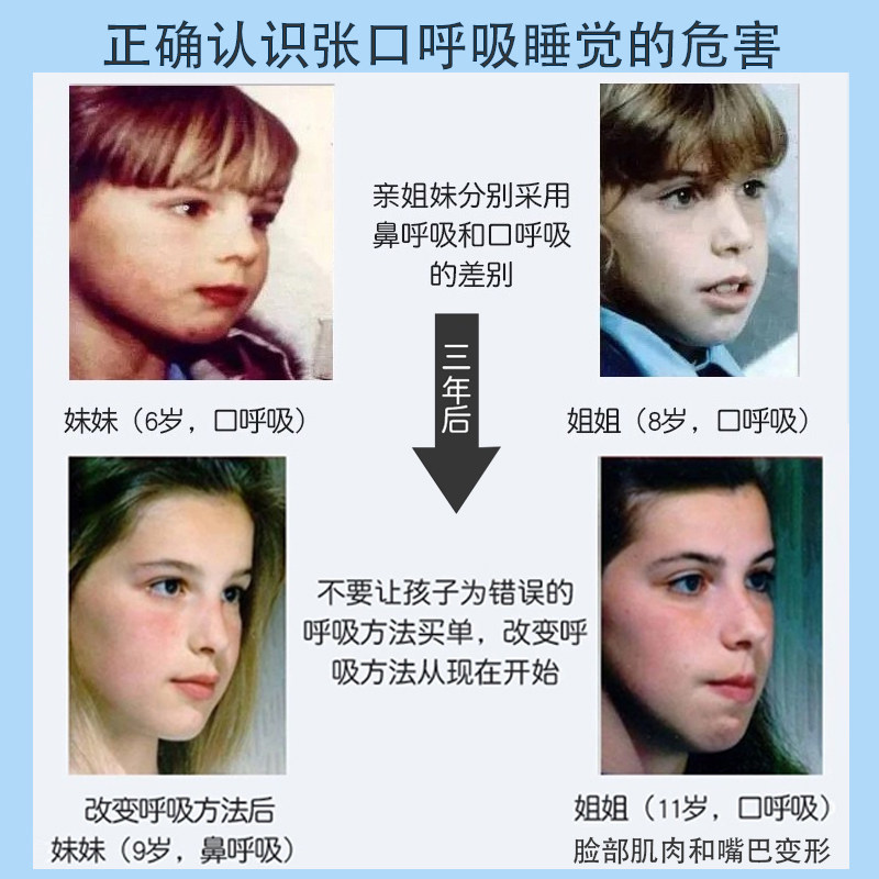 口呼吸矫正贴儿童闭嘴巴防张嘴睡觉神器成人止鼾封嘴封口闭口唇贴,淘宝优惠券,粉丝福利购,淘宝优惠卷