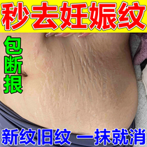 Geschen tattooed elimination of gestational tattooing to belly partum postpartum obese tattooed repair cream Desalinated Scars to Repair Scar Cream