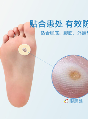 足贴鸡眼贴保护垫水泡