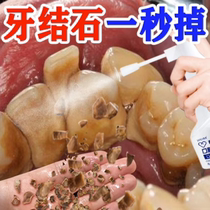 Küchens recommendation) Go to Yellow Stones Smoke Stains Tea Stains Tooth Dirt Clean Gods Men And Women Universal Diviner